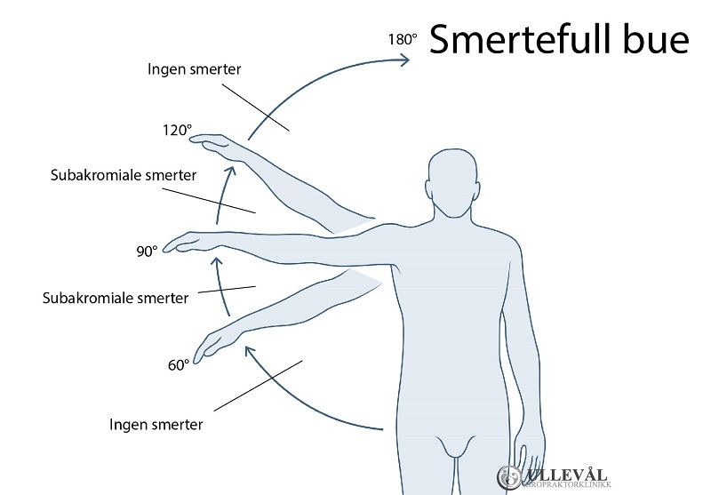 - Smertefull trening:⁤ Årsaker ⁢og risikoer