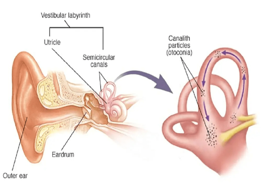 Illustrasjon brukt i behandling av krystallsyke i Lillestrøm